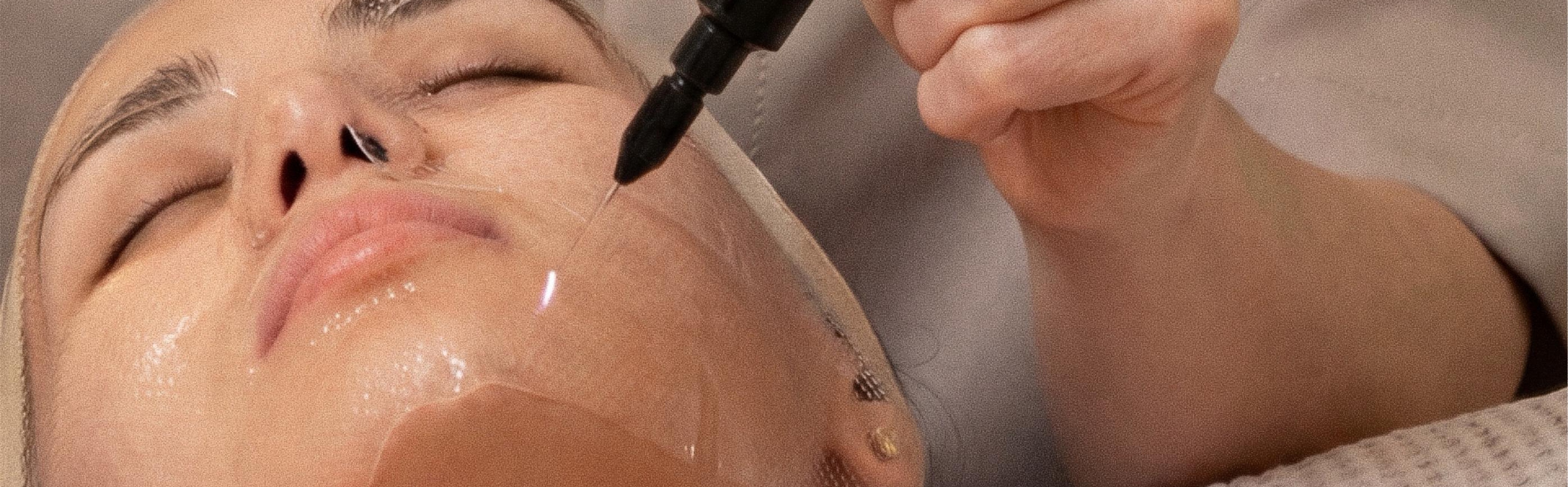 Новая услуга Холодная плазма в FaceRoom!